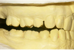 経堂（世田谷区）の歯医者、K.i歯科、顎関節症の原因