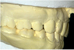 経堂（世田谷区）の歯医者、K.i歯科、顎関節症の原因