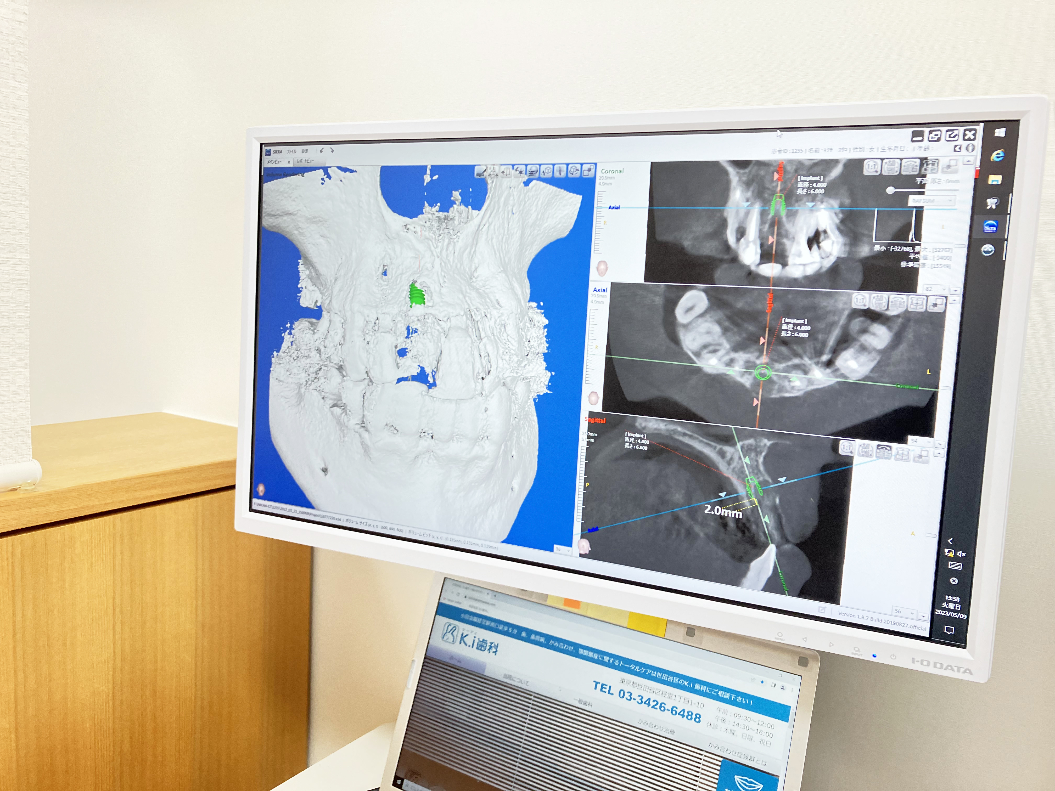経堂（世田谷区）の歯医者、K.i歯科の歯科用ＣＴ
