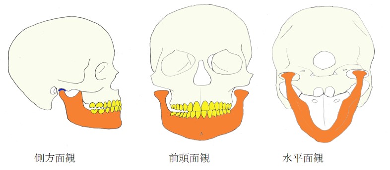経堂（世田谷区）の歯医者、K.i歯科の嚙み合わせ治療