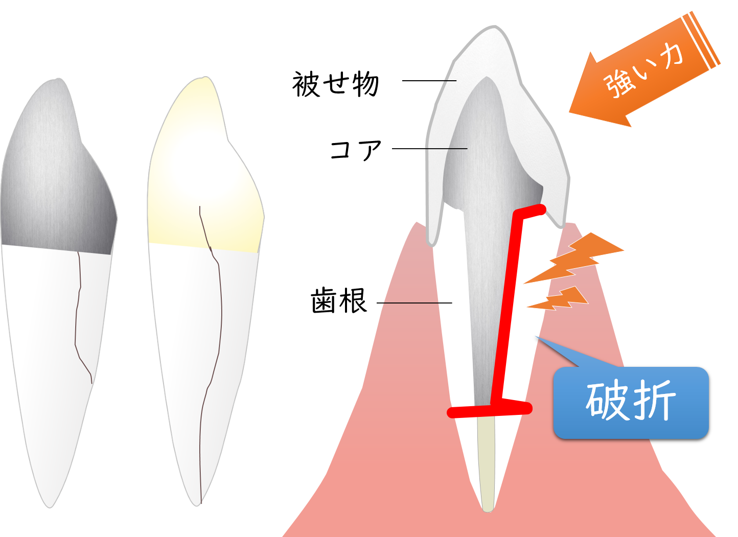 経堂（世田谷区）の歯医者、K.i歯科の歯科用ＣＴ