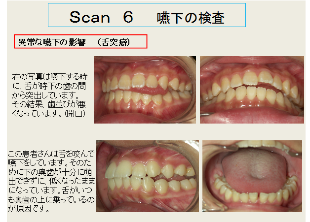経堂（世田谷区）の歯医者、K.i歯科で、科学的な診断と治療