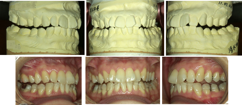 経堂（世田谷区）の歯医者、K.i歯科で、診断と治療の鍵「下顎安静位」