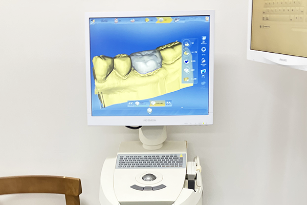 経堂（世田谷区）の歯医者、K.i歯科で、セレック（CAD/CAM）治療